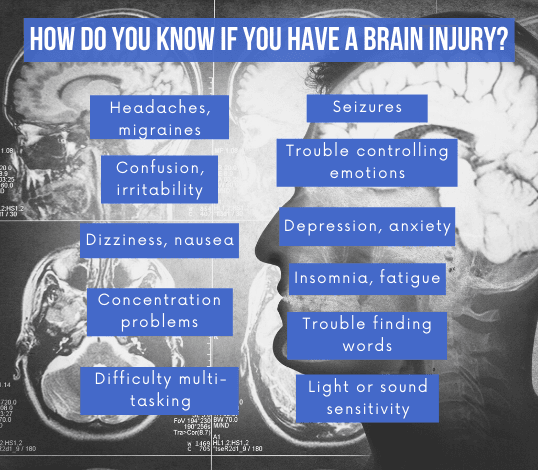 how do you know you have a brain injury infographic
