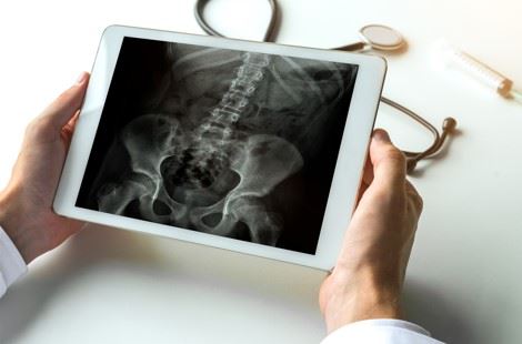 doctor looking at spinal cord xray on ipad